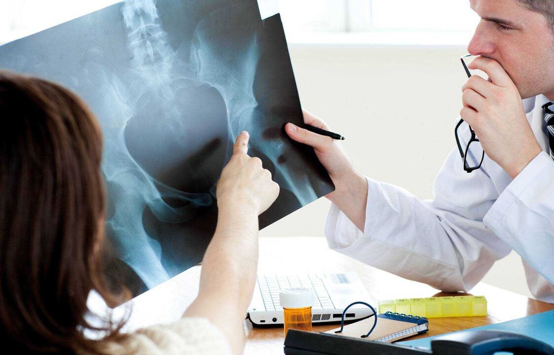 médecins examinant une radiographie pour l'arthrose de la hanche